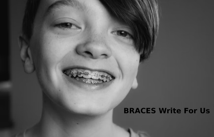 BRACES Write For Us 