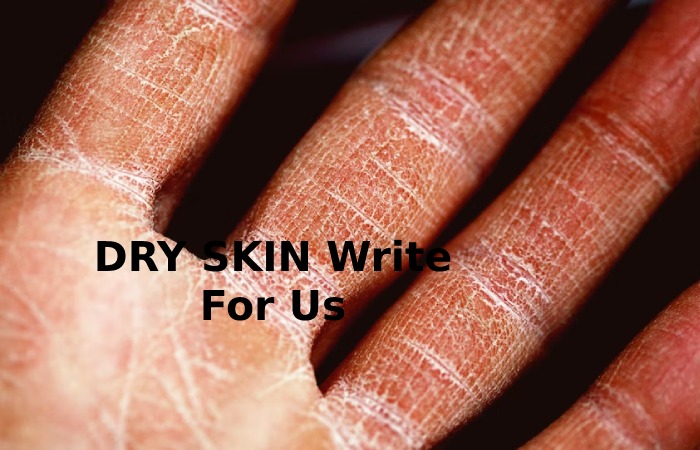 DRY SKIN Write For Us