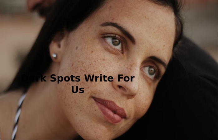 Dark Spots Write For Us 