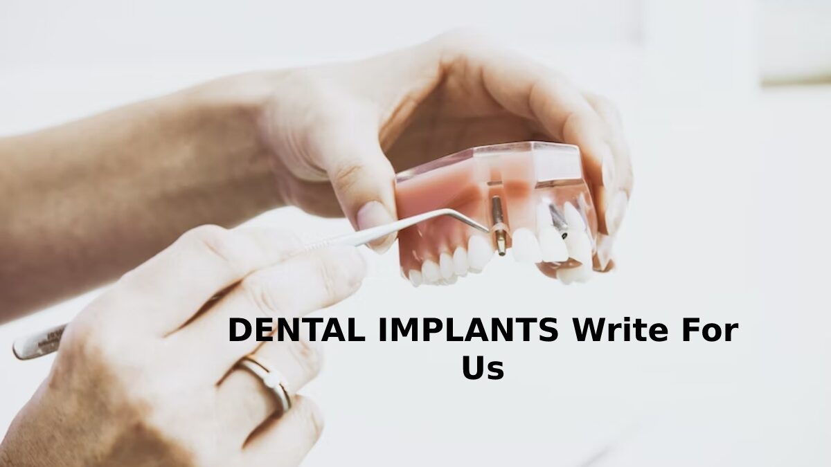DENTAL IMPLANTS Write For Us DENTAL IMPLANTS Guest Blog Submission