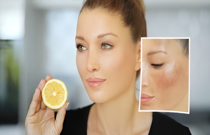 Wellhealthorganic.Com Easily Remove Dark Spots Lemon Juice
