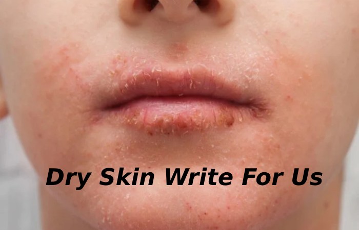 Dry skin Write For Us