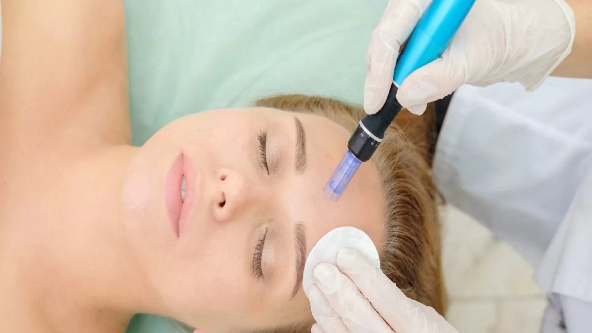 Professional Microneedling Serums: Ways to Get Best Results