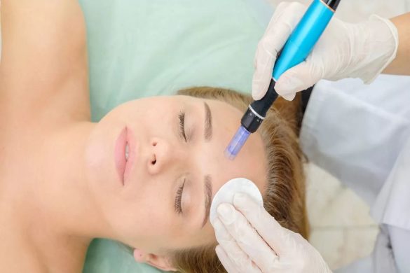 Professional Microneedling Serums_ Ways to Get Best Results